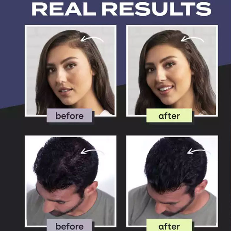 Hair Building Fibers Kit for a Fuller-Looking Style